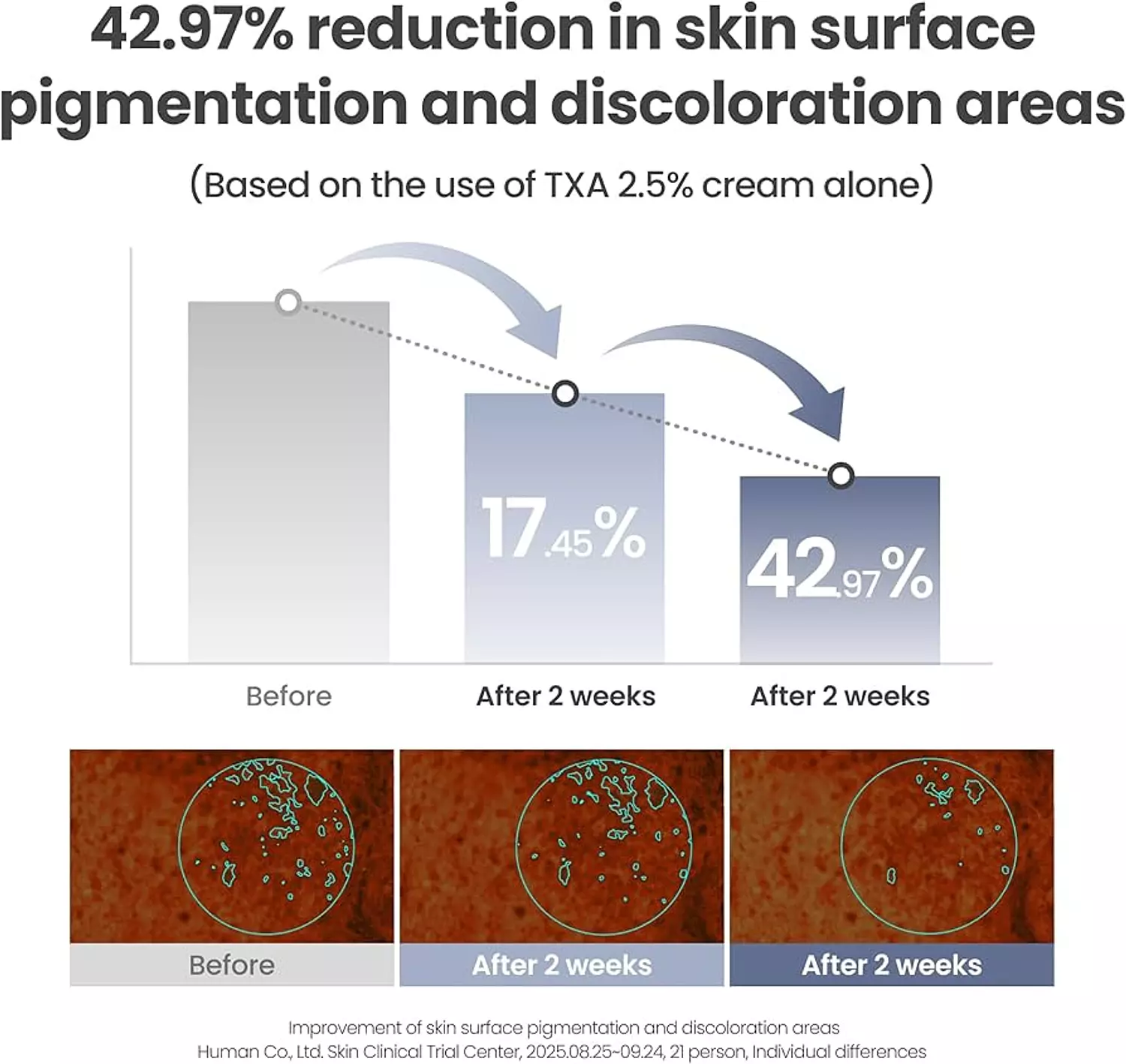 AXIS - Y - TXA 2.5% Intensive Brightening Cream 50ml 5
