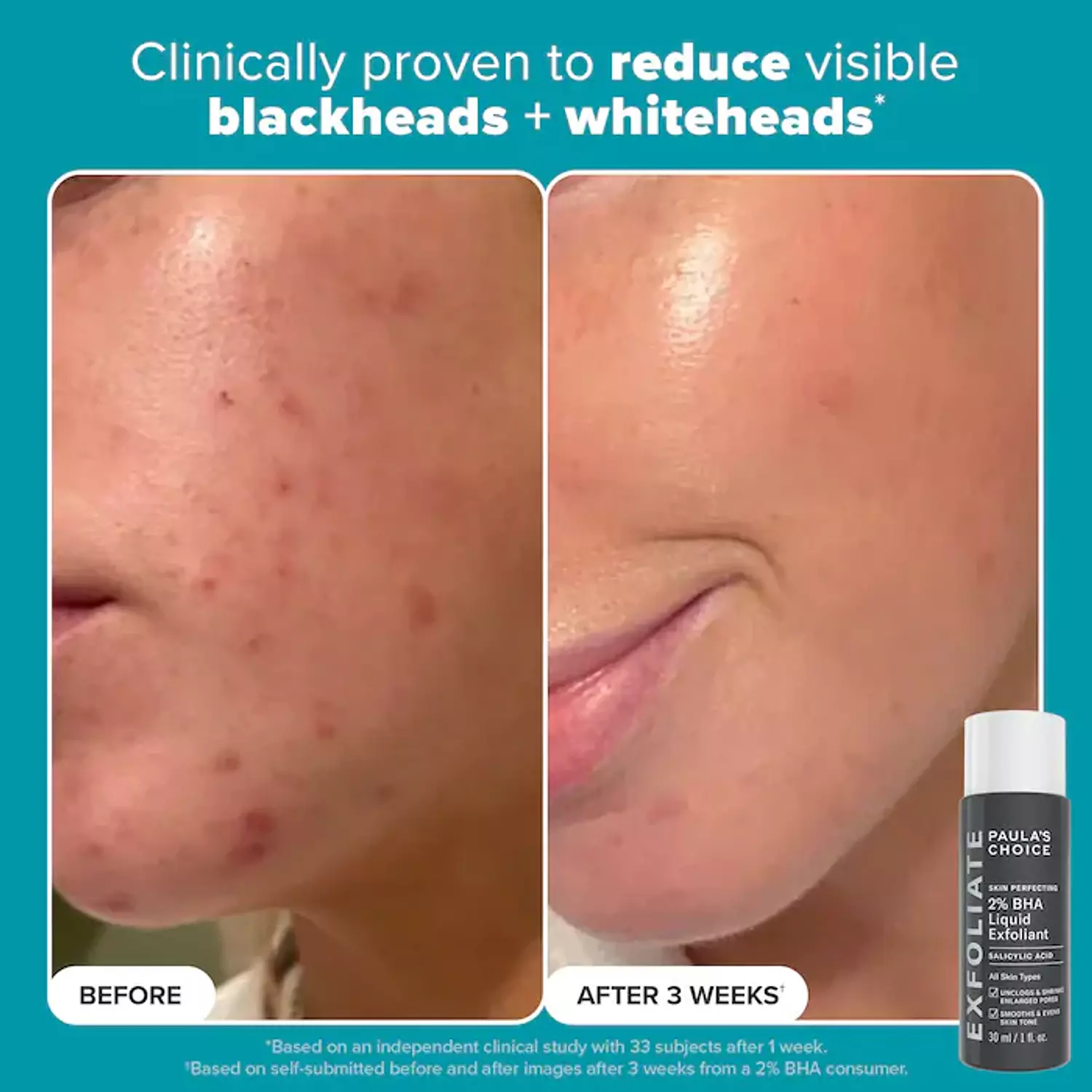 Paula's Choice  Exfoliation Icons Kit for clear, brighter looking skin 3