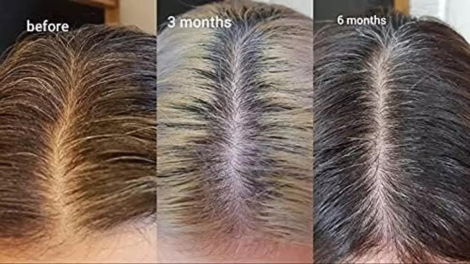 The Ordinary Multi Peptide Serum for Hair Density 1
