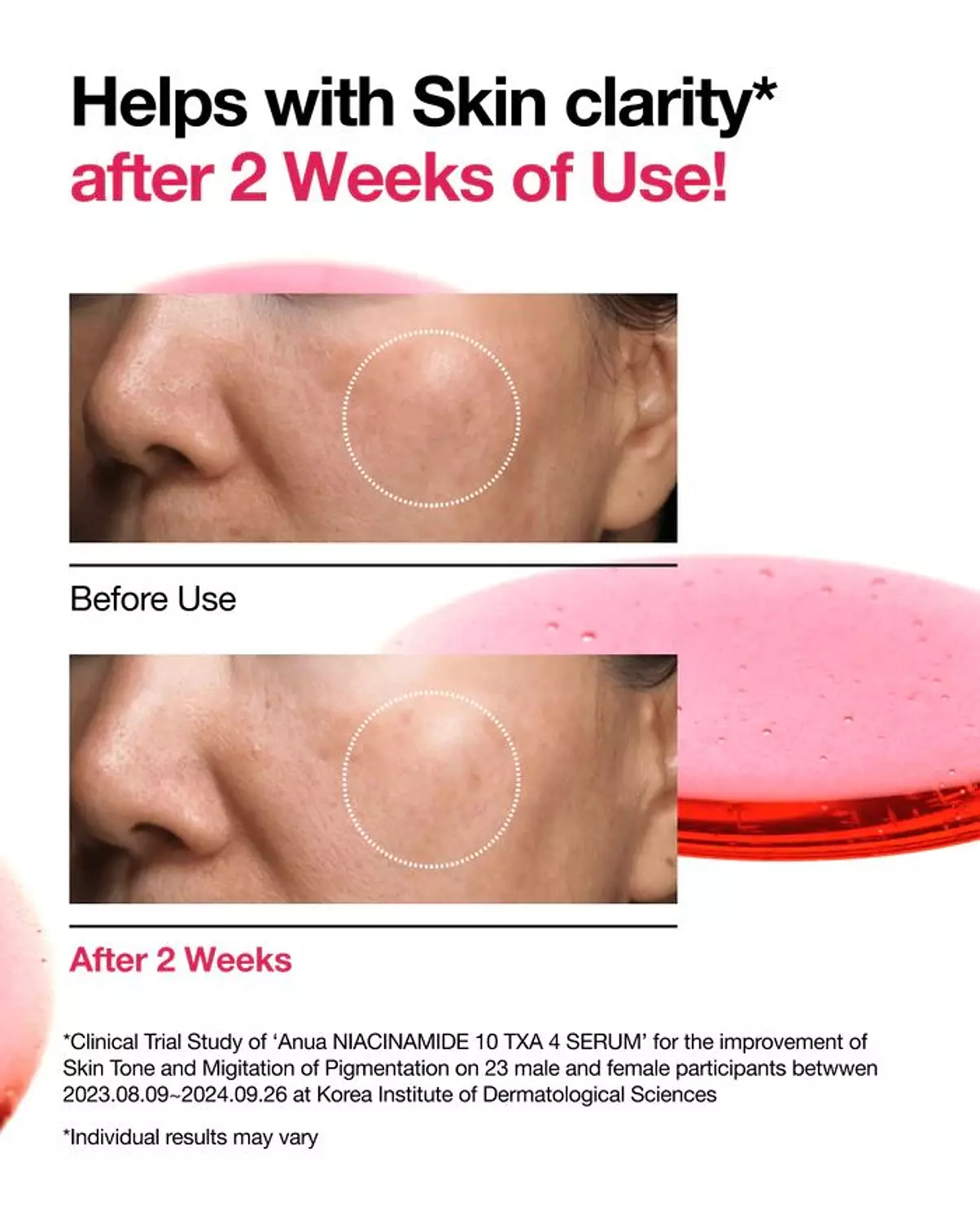 Anua NIACINAMIDE 10%+TXA 4% Serum 2