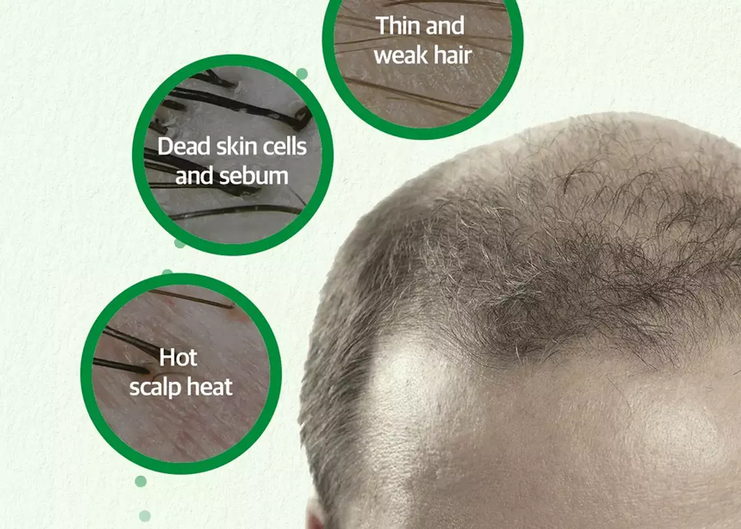 SOME BY MI - Cica Peptide Anti Hair Loss Derma Scalp Tonic hover image