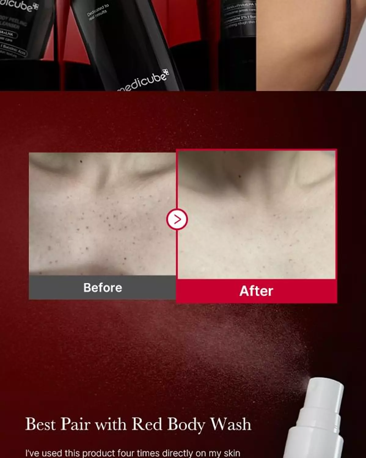 Medicube - Red Acne Body Peeling Shot 1