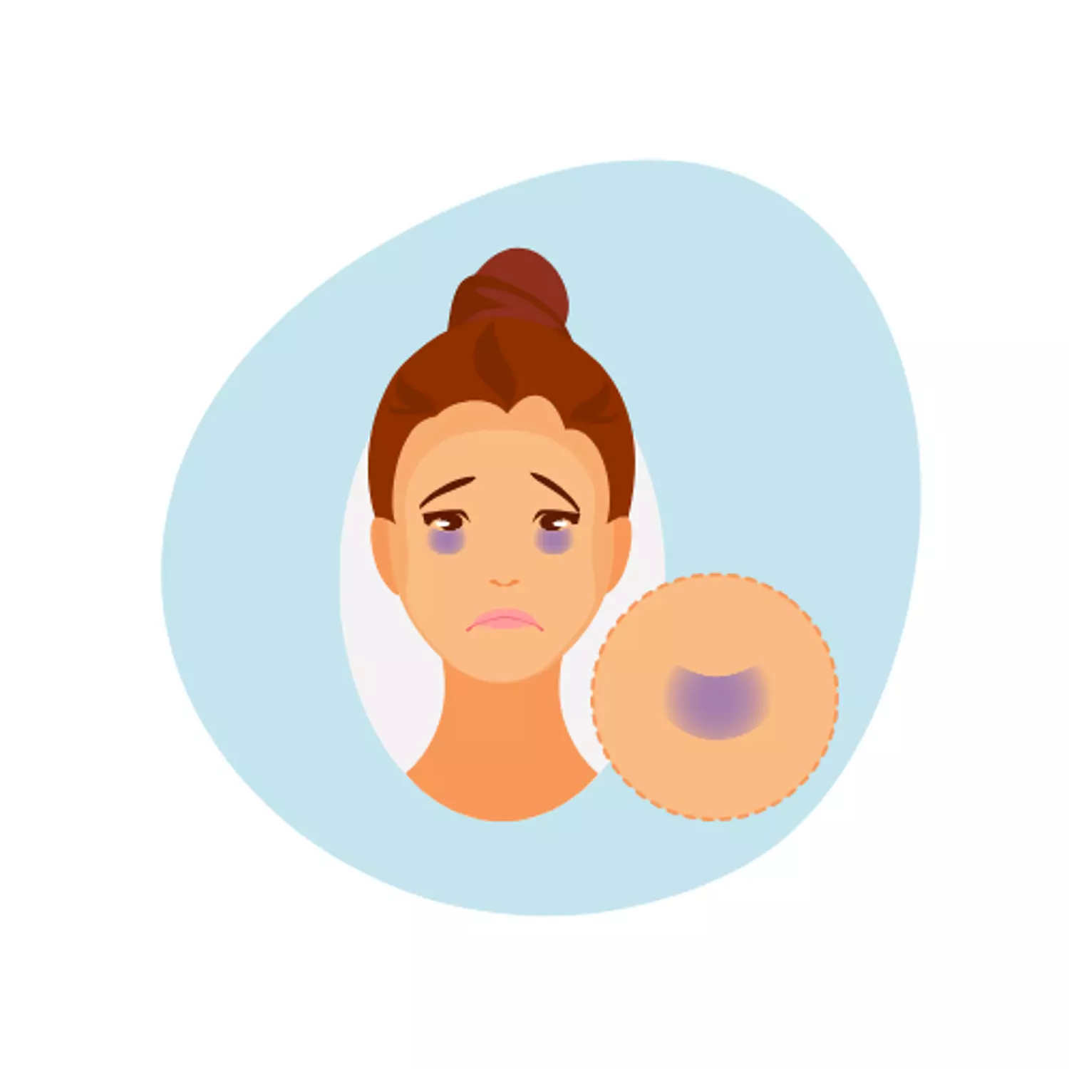 <h4 style="text-align: center">Dark Circles</h4>