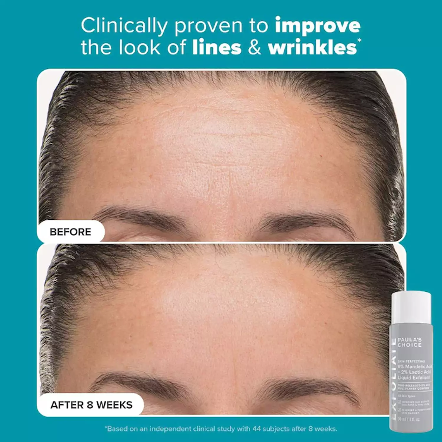 Paula's Choice  Exfoliation Icons Kit for clear, brighter looking skin 4