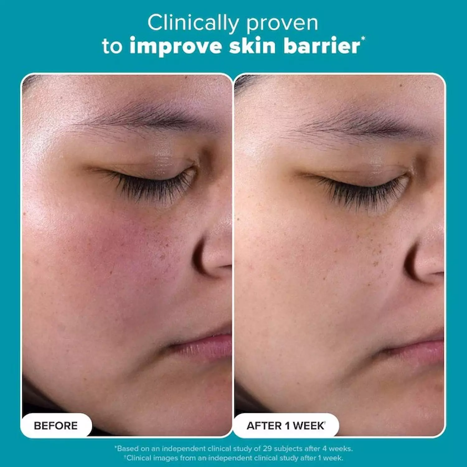 Paula's Choice  Skin Perfecting 2% BHA Exfoliating Toner for Clear Skin 3