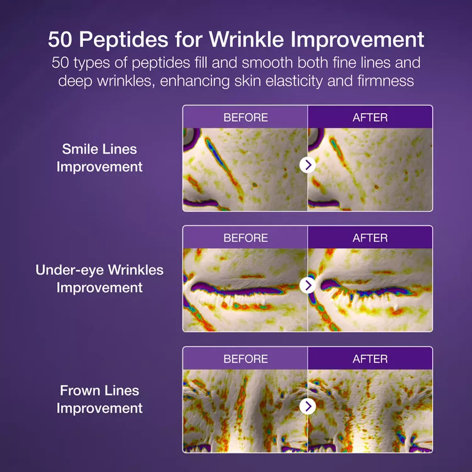 Numbuzin - No.9 NAD Bio Lifting-sil Essence 50ml 2