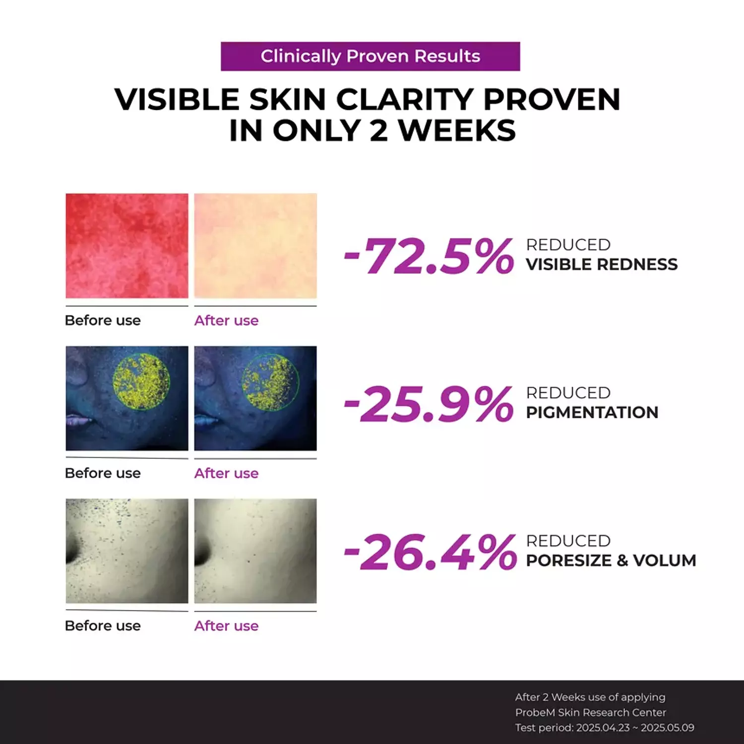 JUMISO - Niacinamide 10 Serum 4