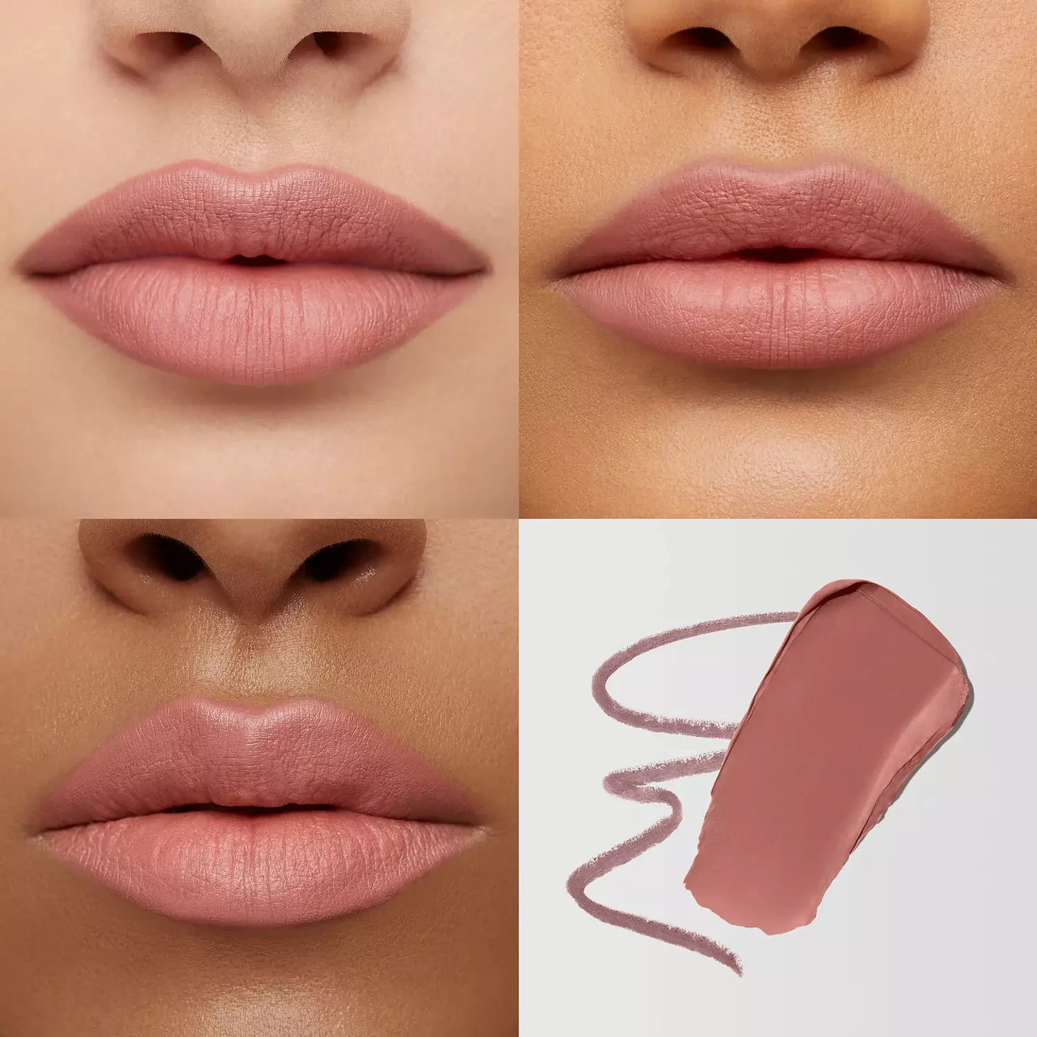 MARIO'S LIP LIFT™ KIT 2