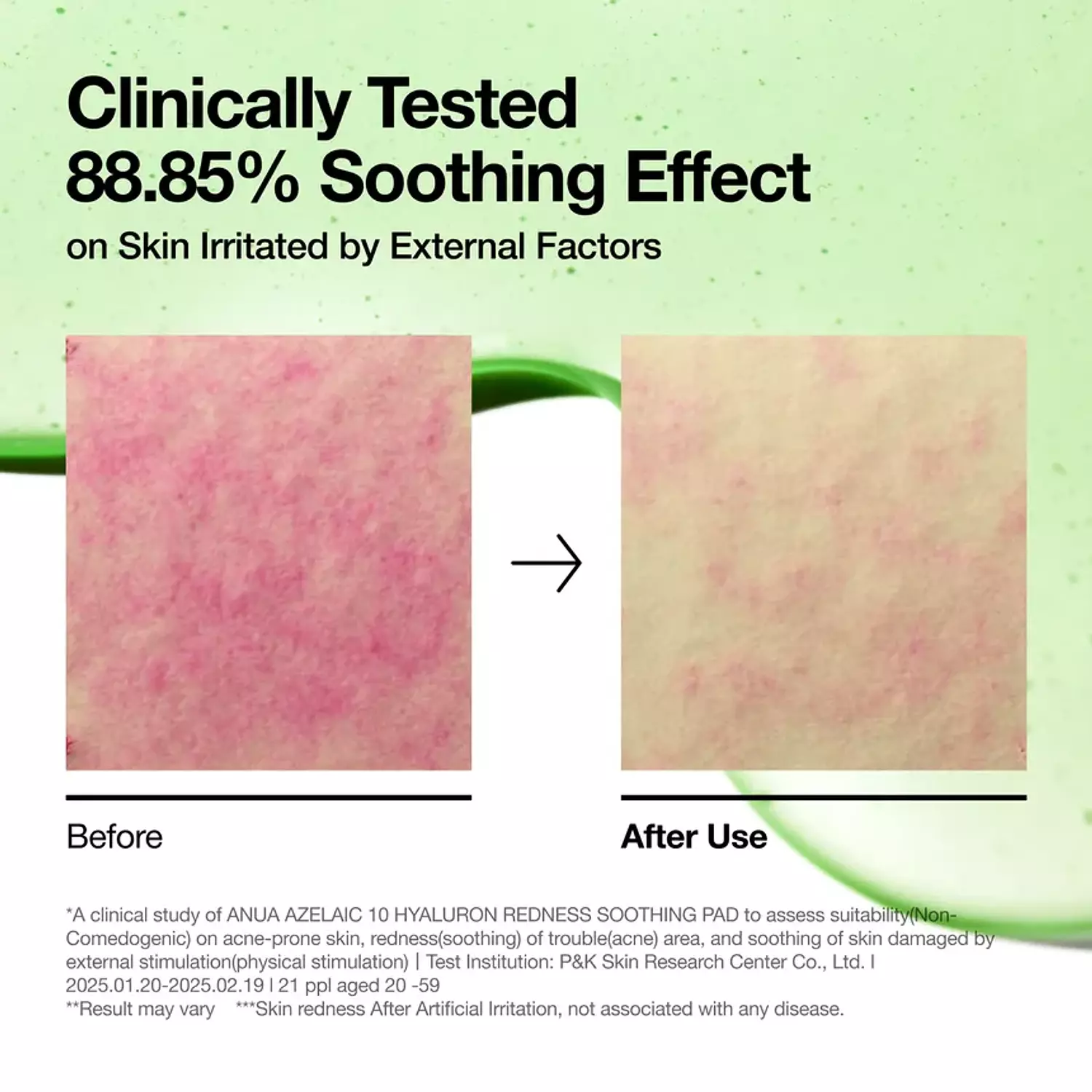 Anua - Azelaic 10 Hyaluron Redness Soothing Pad 3