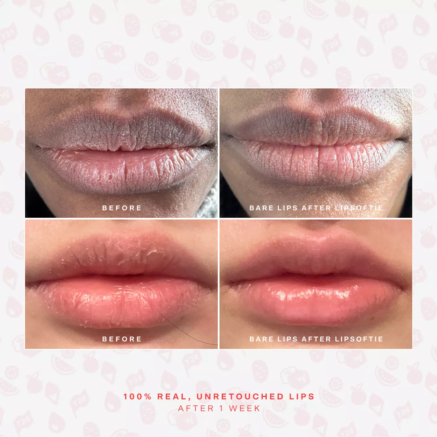Tower28 LipSoftie® Lip Treatment 6