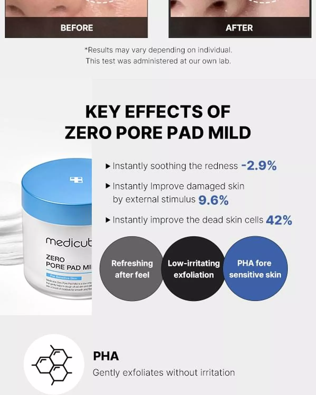 Medicube - Zero Pore Pad Mild 1