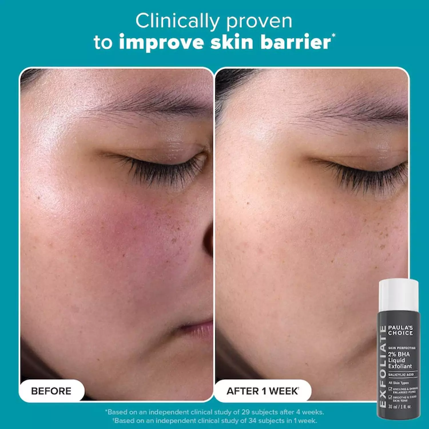 Paula's Choice  Exfoliation Icons Kit for clear, brighter looking skin 2