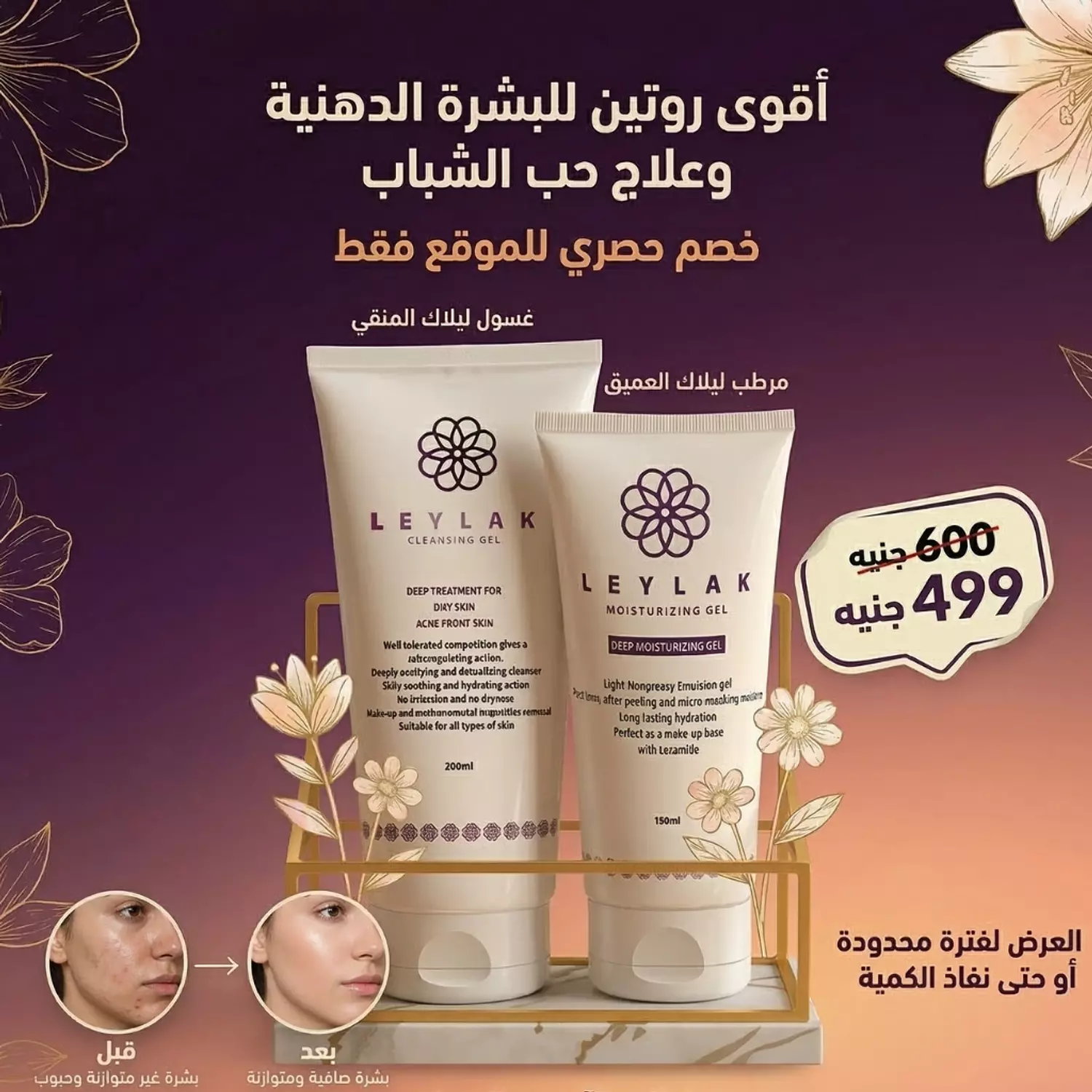 Leylak Acne DUO OFFER image