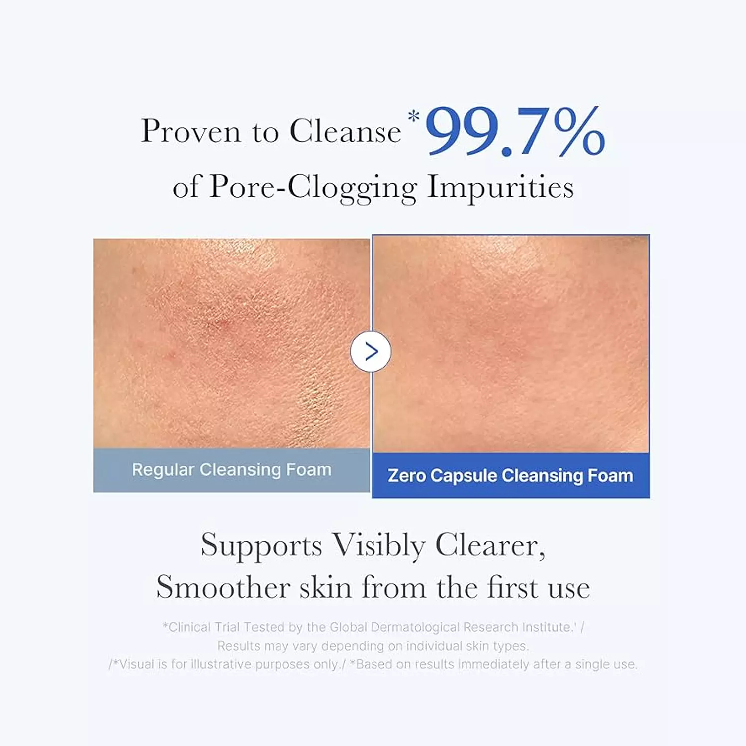 medicube - Zero Pore SA Clear Capsule Cleansing Foam 120ml 4