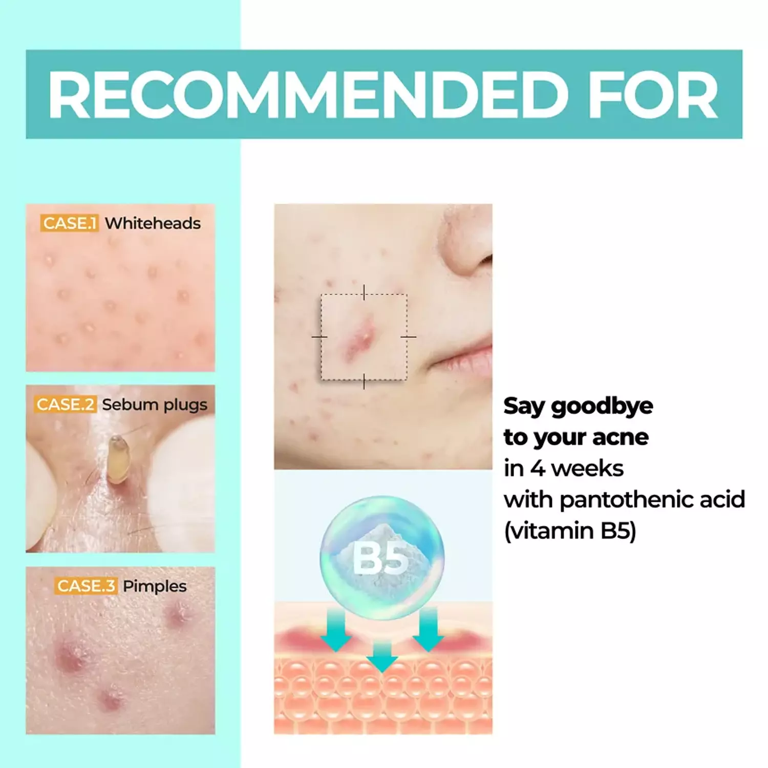 Numbuzin - No.1 Pantothenic B5 Active Soothing Cream 3