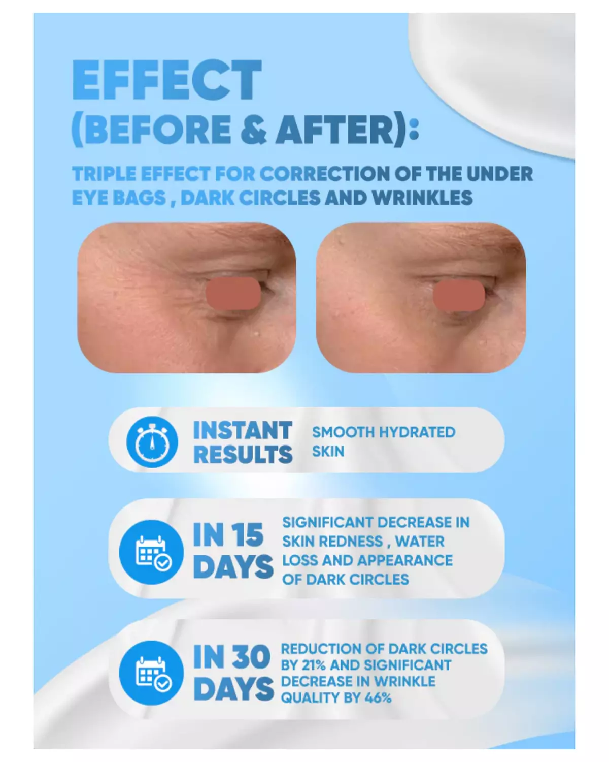 Glamy Lab Eye Contour Filler   2