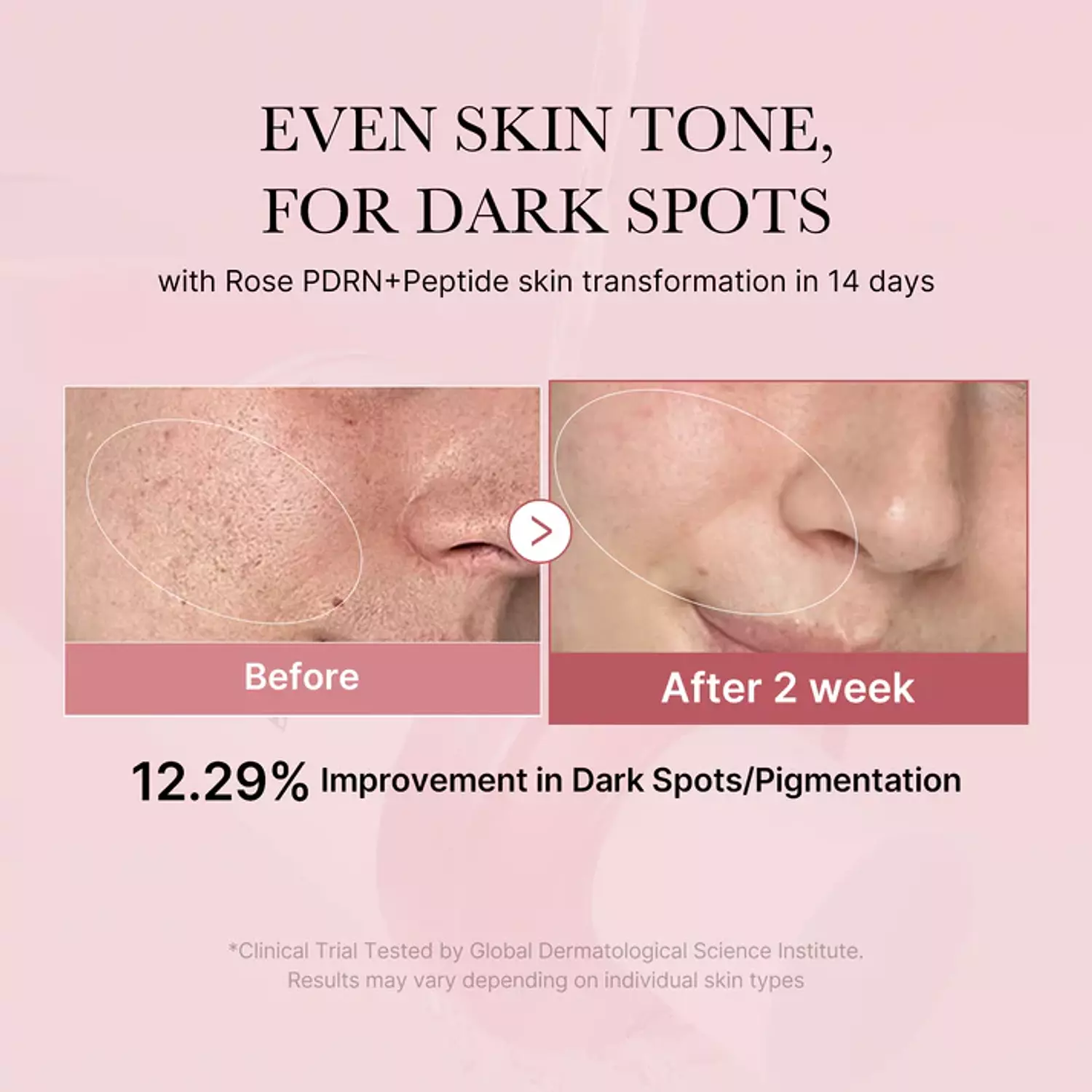 Medicube PDRN Pink Peptide Toner 1