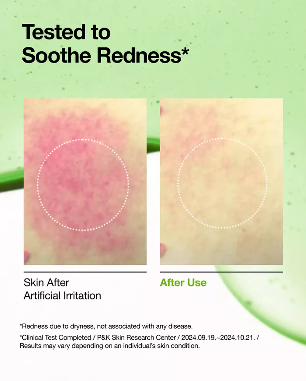 Anua Azelaic Acid 10 Hyaluron Redness Soothing Serum 3