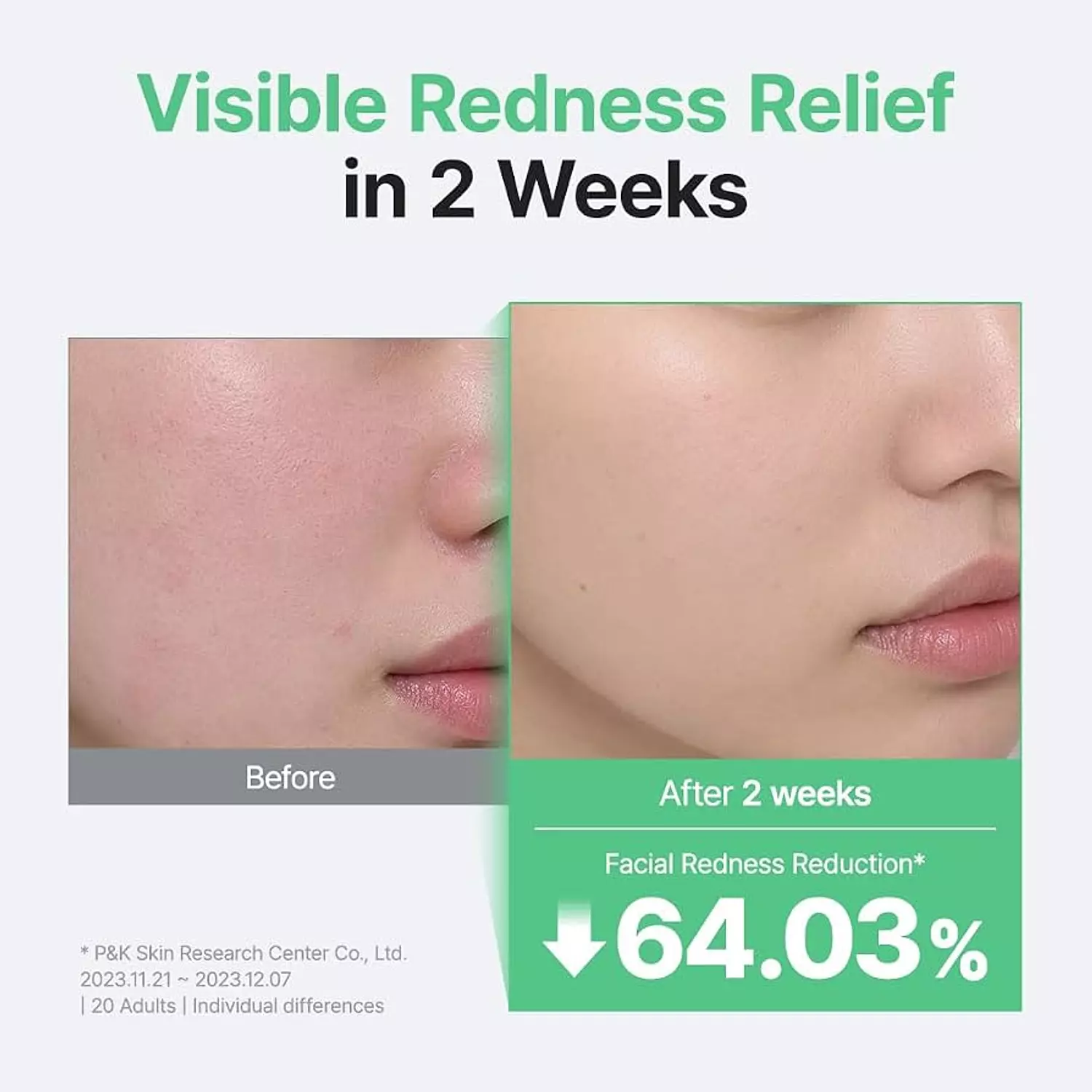 Purito SEOUL - Wonder Releaf Centella Serum Unscented 4