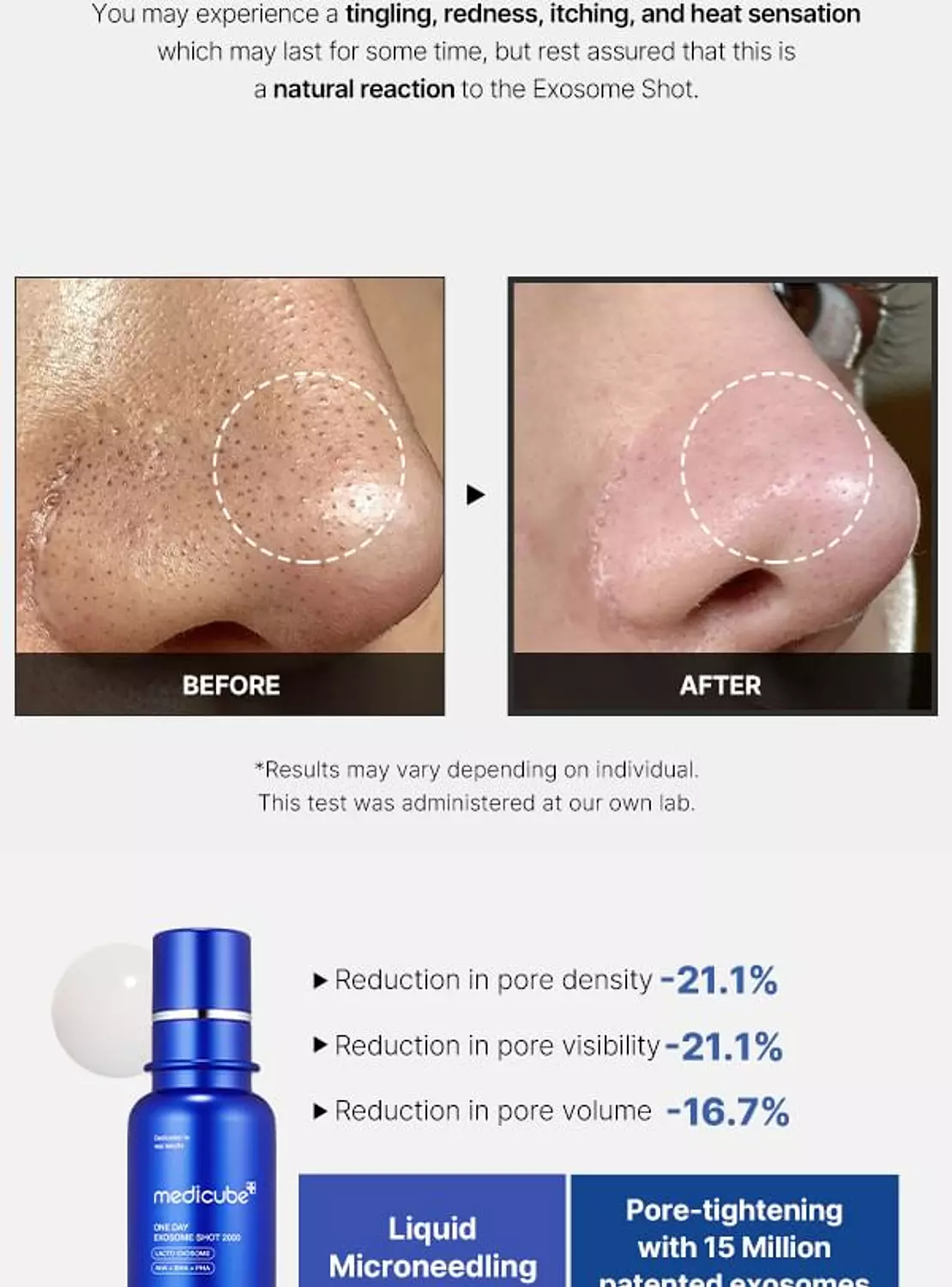 Medicube - One Day Exosome Shot Pore Ampoule 7500 4