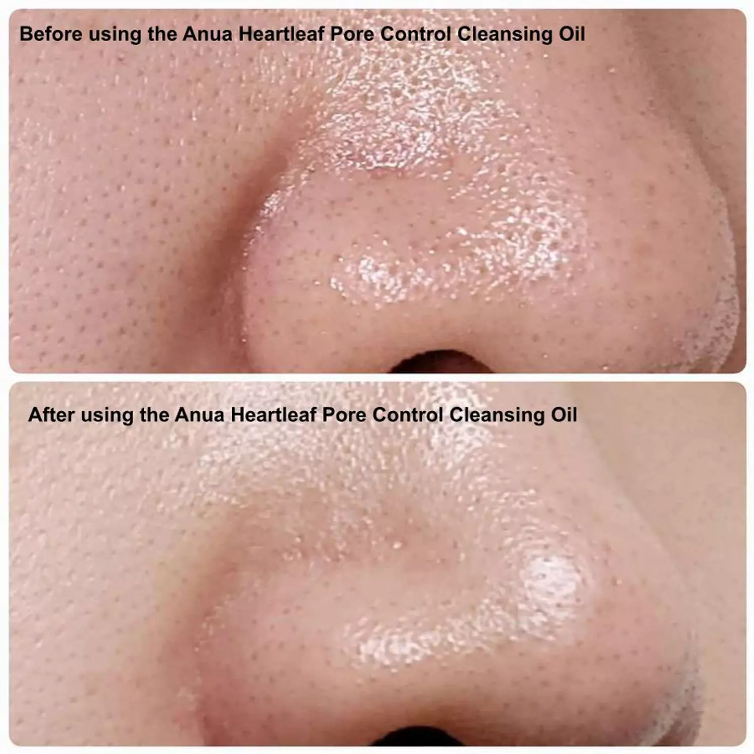 Anua - Heartleaf Pore Control Cleansing Oil Mild 1