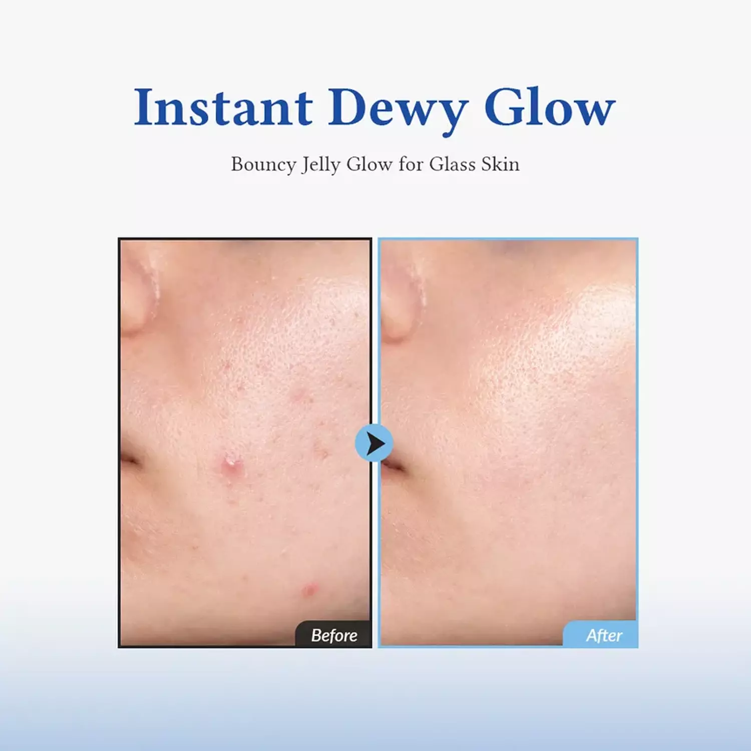 Dr. Althea - Aqua Marine Jelly Mist 2