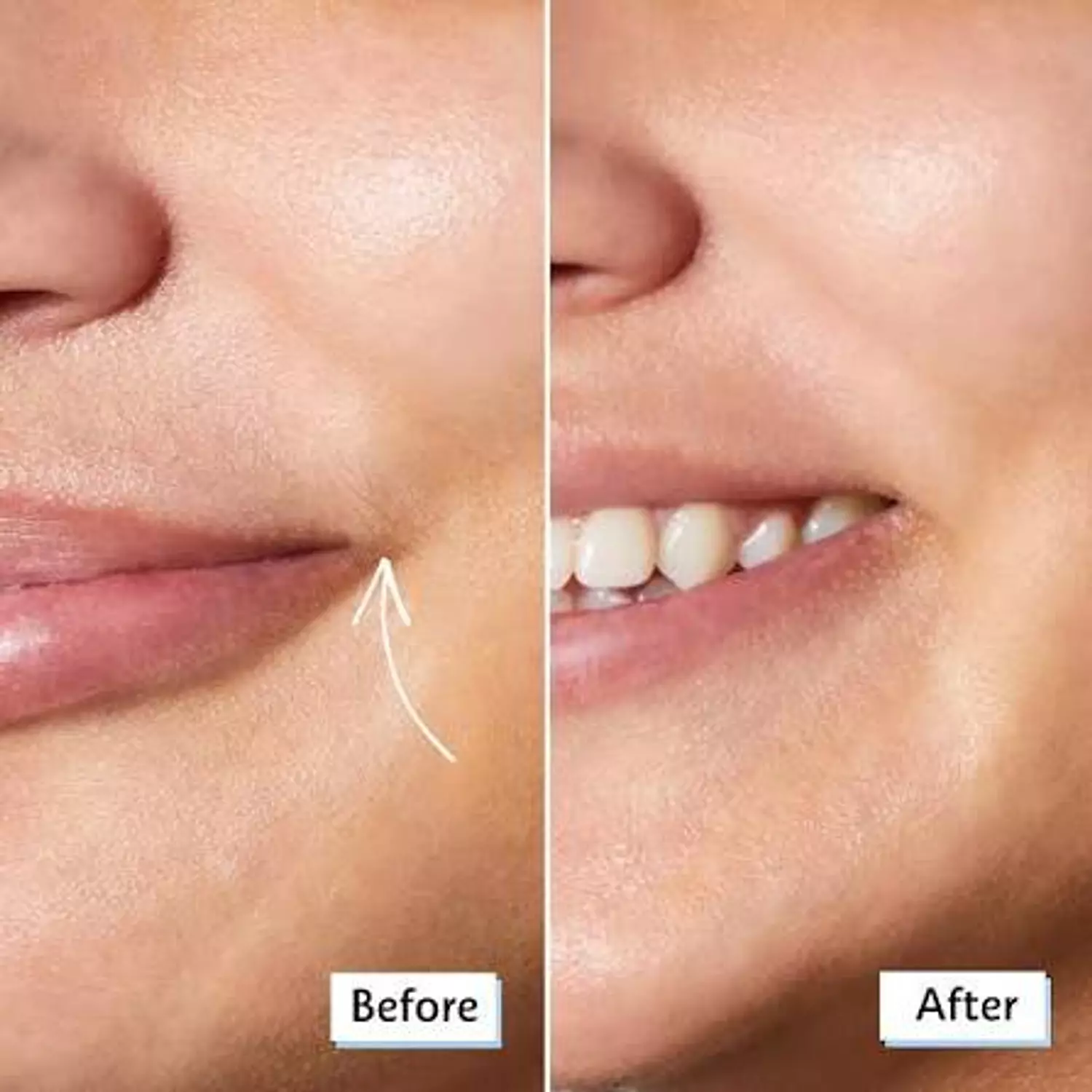 Sephora Eyebrow Razor Set 2