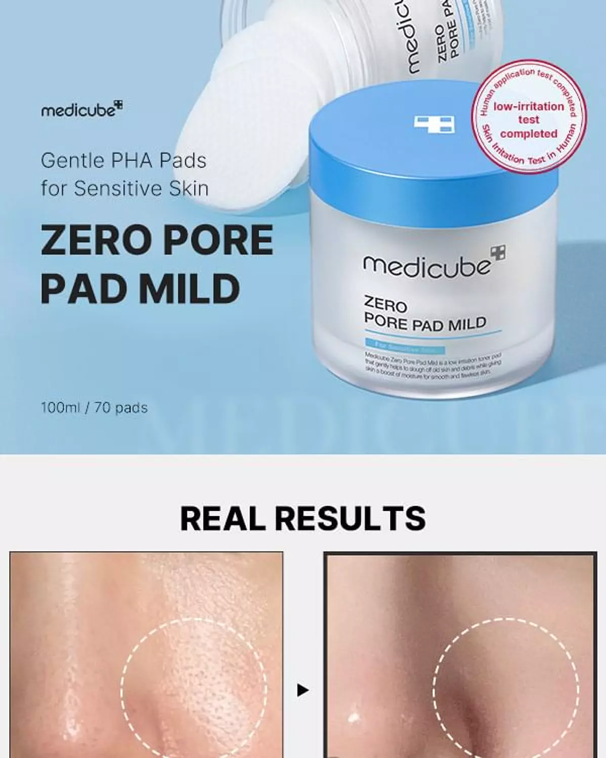 Medicube - Zero Pore Pad Mild 3
