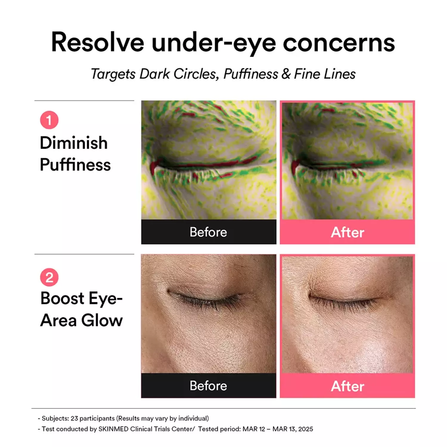 Abib - PDRN Retinal Eye Patch Glow Jelly 2