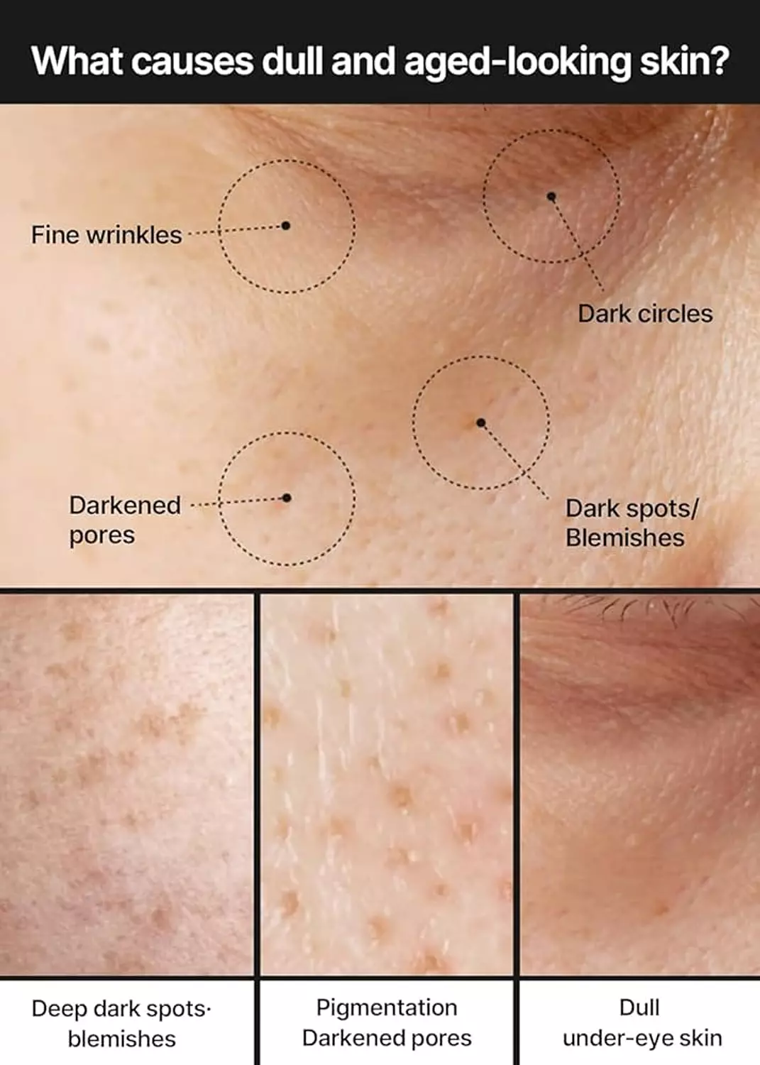 celimax - Pore+Dark Spot Brightening Cream 35ml 1