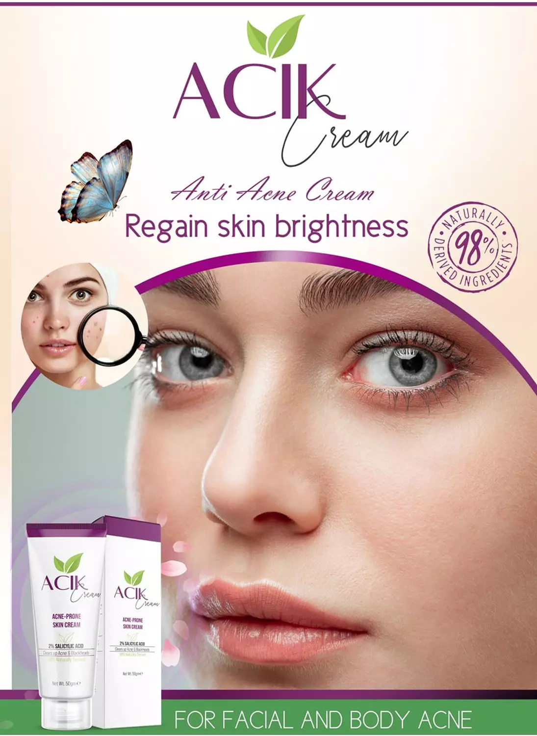 ACIK ACNE PRONE SKIN CREAM 50 GM 5