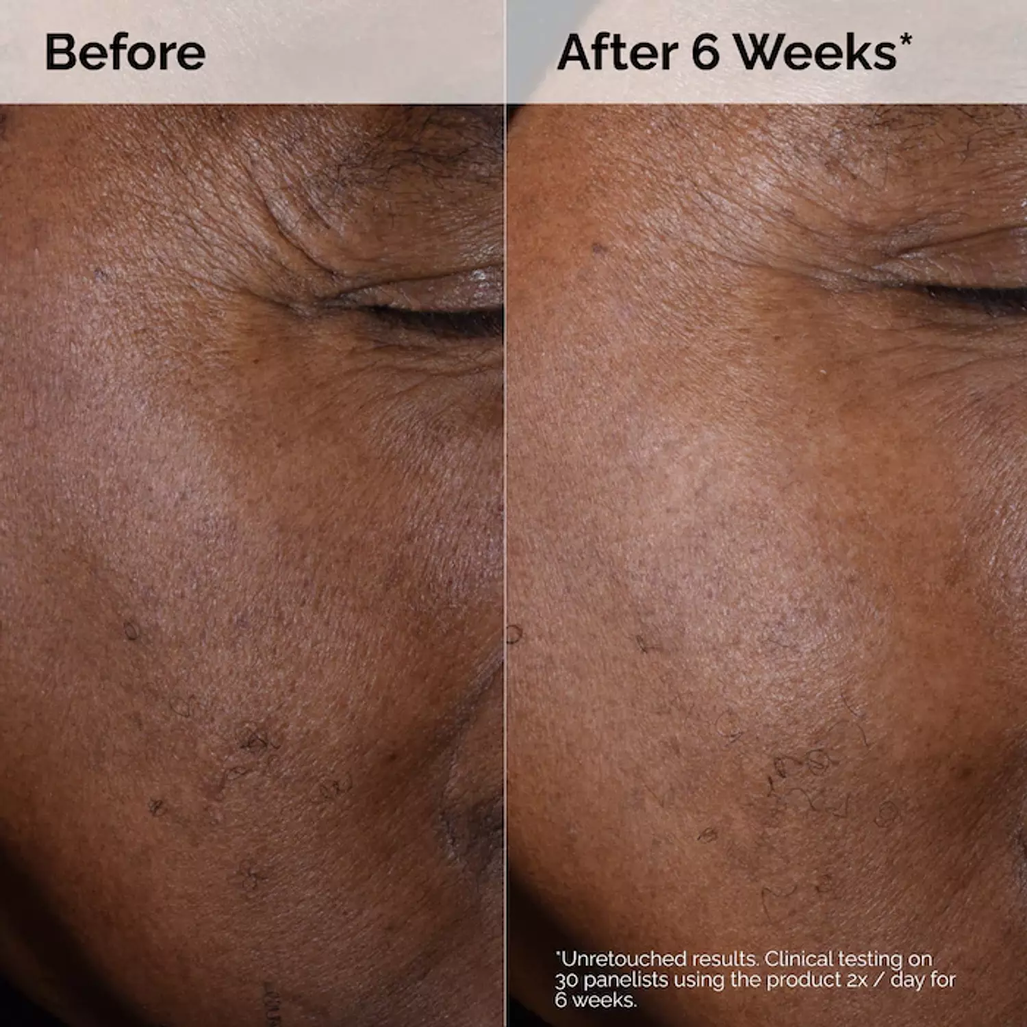 The Ordinary Glycolic Acid 7% Exfoliating Toner 240ml 7