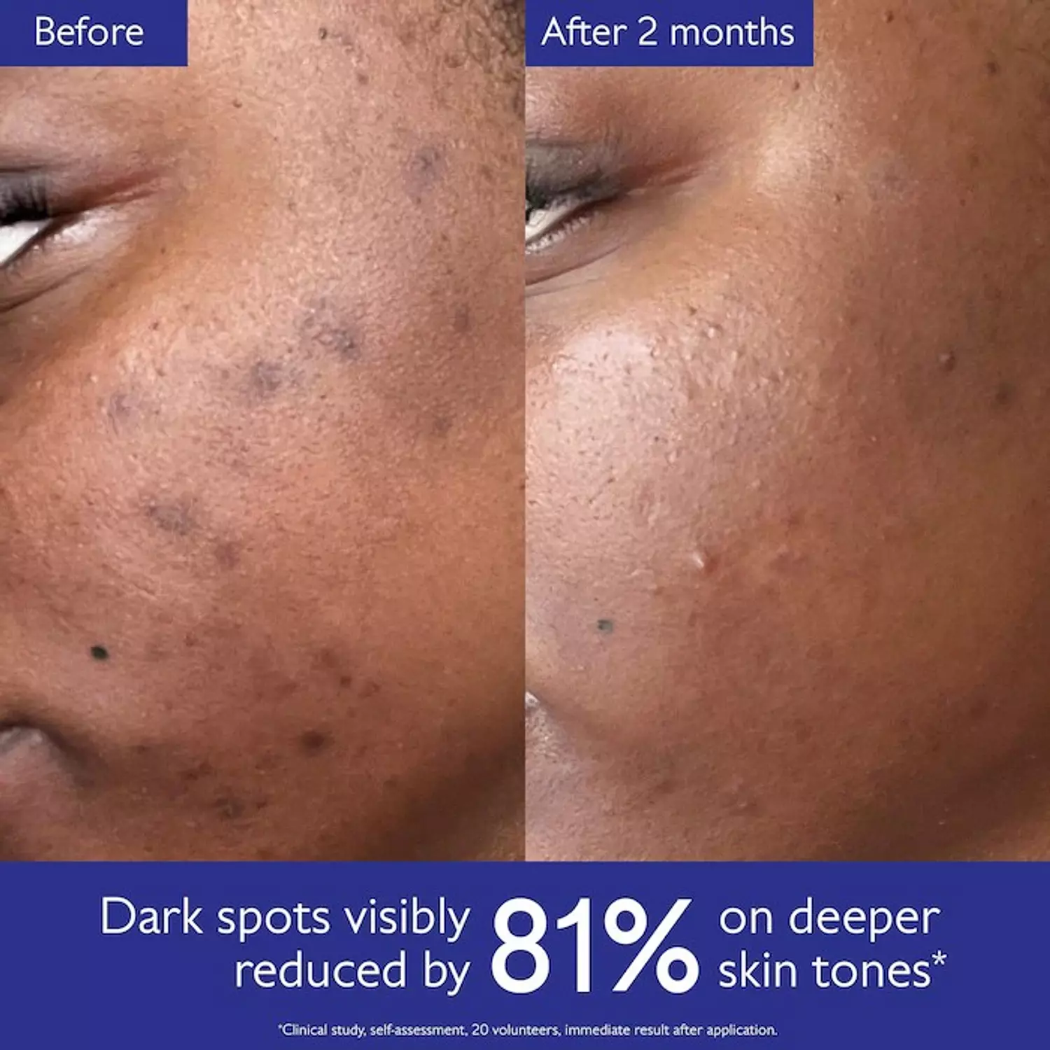 Caudalie  Vinoperfect Brightening Dark Spot Serum Vitamin C Alternative 10 ml 3